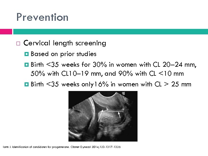 Prevention Cervical length screening Based on prior studies Birth <35 weeks for 30% in