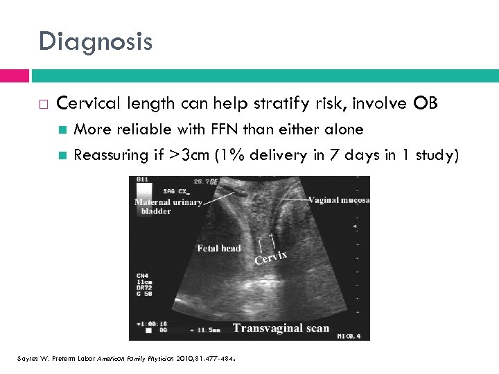 Diagnosis Cervical length can help stratify risk, involve OB More reliable with FFN than