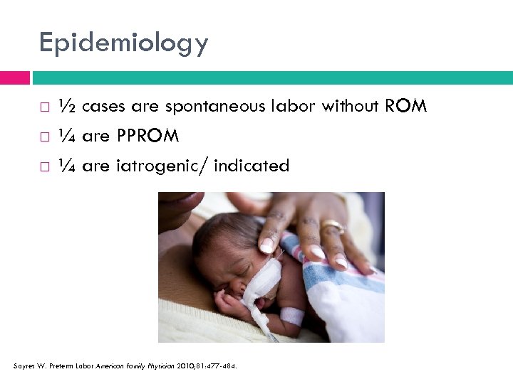 Epidemiology ½ cases are spontaneous labor without ROM ¼ are PPROM ¼ are iatrogenic/