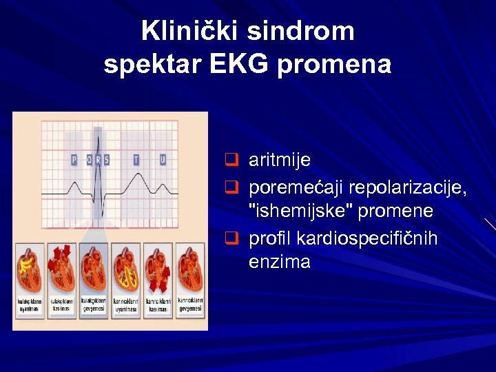 Klinički sindrom spektar EKG promena q aritmije q poremećaji repolarizacije, "ishemijske" promene q profil
