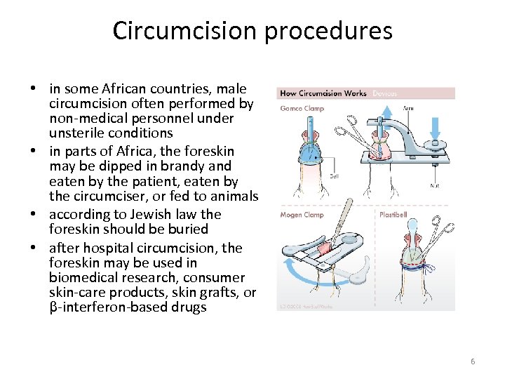 Circumcision procedures • in some African countries, male circumcision often performed by non-medical personnel