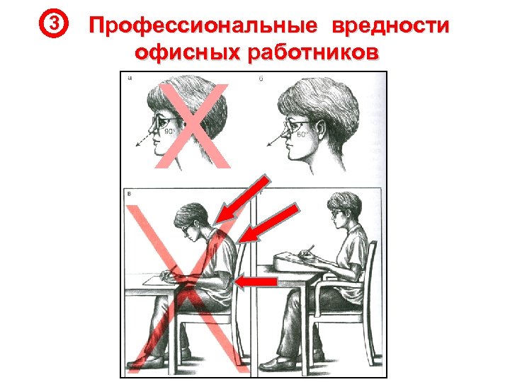 3 Профессиональные вредности офисных работников Х 