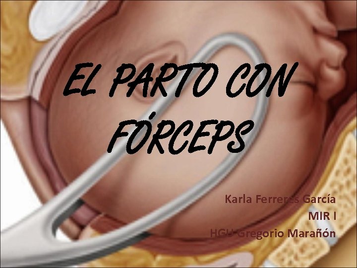 EL PARTO CON FÓRCEPS Karla Ferreres García MIR I HGU Gregorio Marañón 