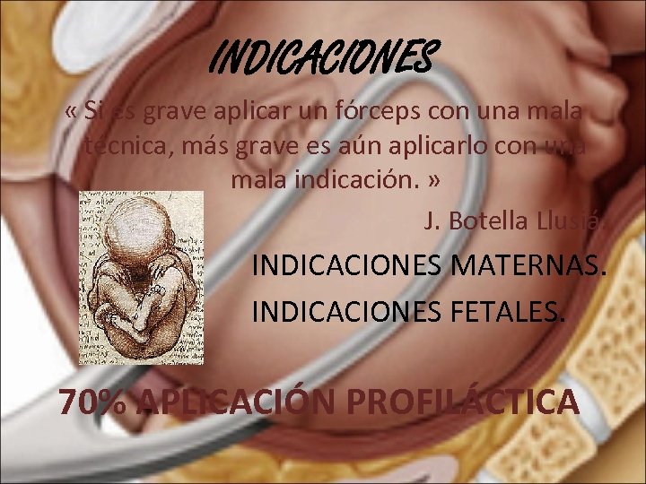 INDICACIONES « Si es grave aplicar un fórceps con una mala técnica, más grave