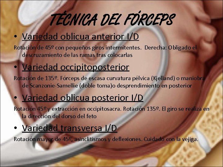 TÉCNICA DEL FÓRCEPS • Variedad oblicua anterior I/D Rotación de 45º con pequeños giros