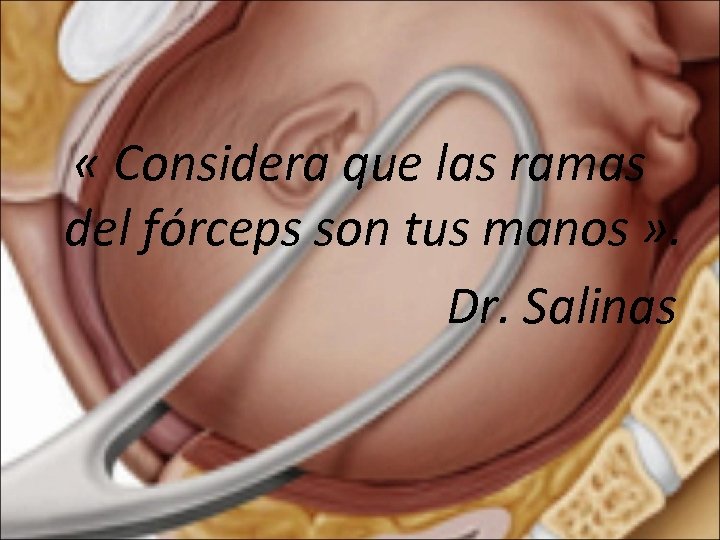  « Considera que las ramas del fórceps son tus manos » . Dr.