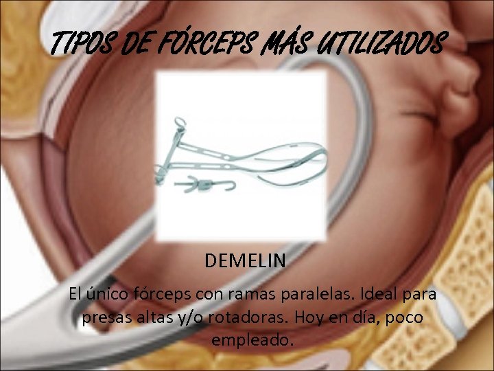 TIPOS DE FÓRCEPS MÁS UTILIZADOS DEMELIN El único fórceps con ramas paralelas. Ideal para