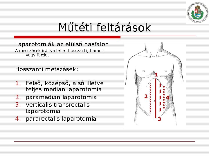 Műtéti feltárások Laparotomiák az elülső hasfalon A metszések iránya lehet hosszanti, haránt vagy ferde.