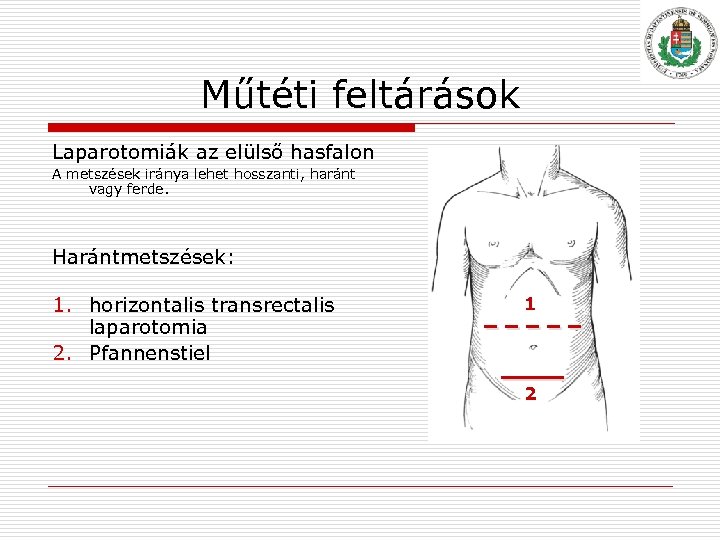 Műtéti feltárások Laparotomiák az elülső hasfalon A metszések iránya lehet hosszanti, haránt vagy ferde.