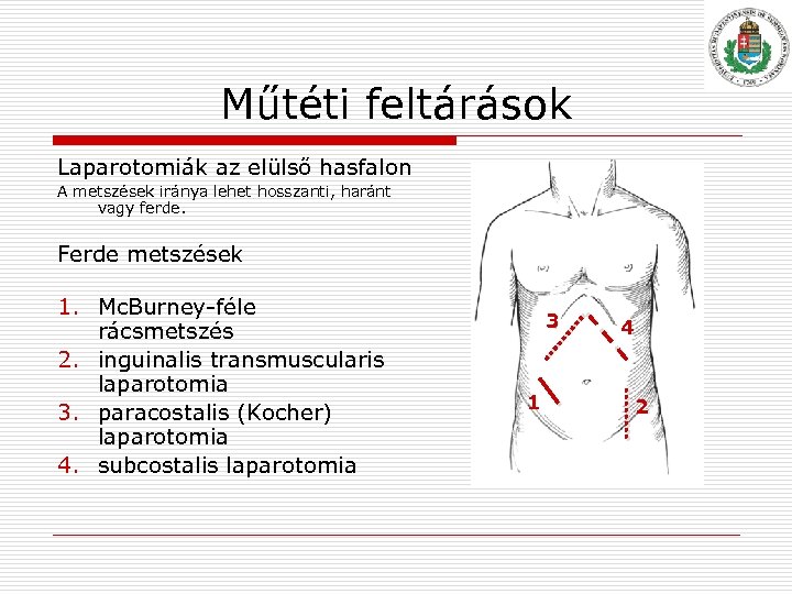 Műtéti feltárások Laparotomiák az elülső hasfalon A metszések iránya lehet hosszanti, haránt vagy ferde.