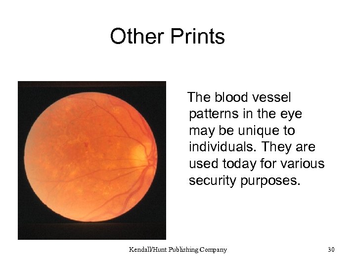 Other Prints The blood vessel patterns in the eye may be unique to individuals.