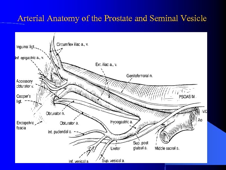 Arterial Anatomy of the Prostate and Seminal Vesicle 