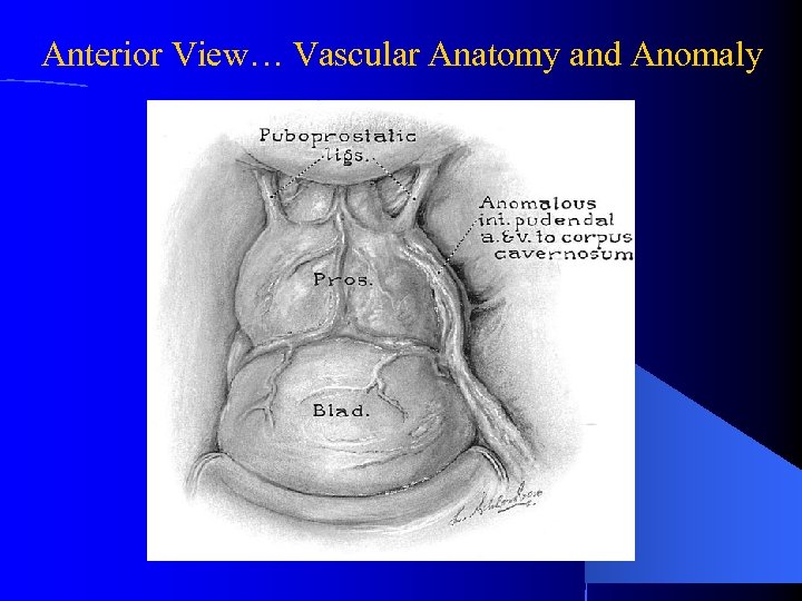 Anterior View… Vascular Anatomy and Anomaly 