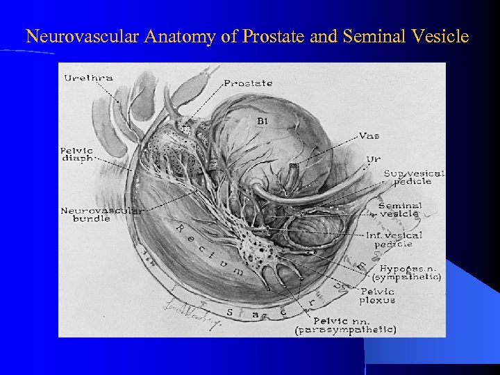 Neurovascular Anatomy of Prostate and Seminal Vesicle 