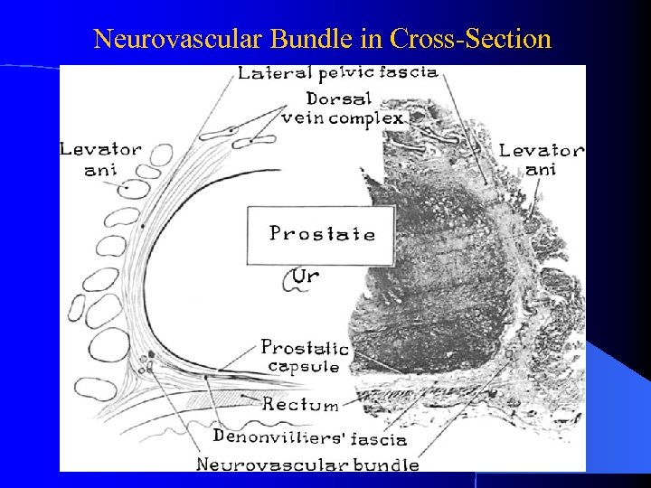 Neurovascular Bundle in Cross-Section 