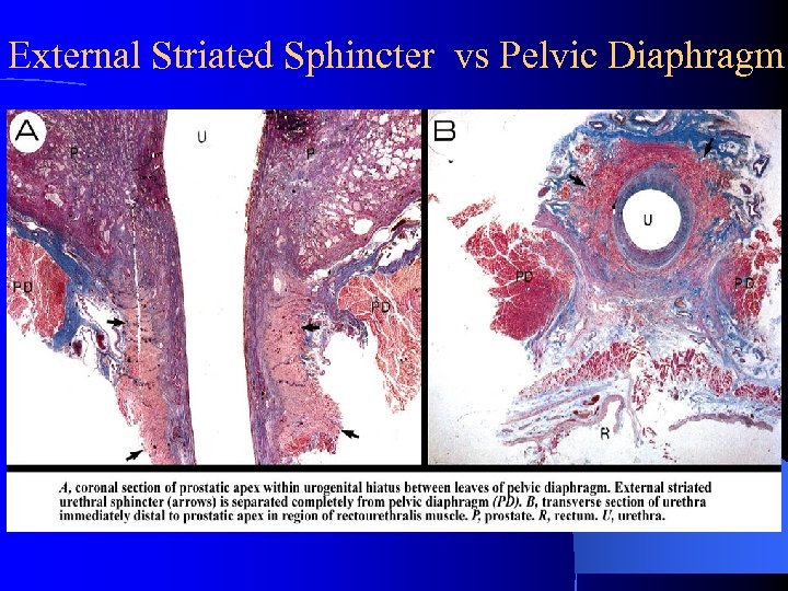 External Striated Sphincter vs Pelvic Diaphragm 