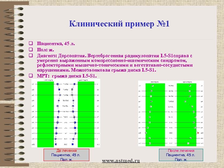 Клинический пример № 1 q Пациентка, 45 л. q Пол: ж. q Диагноз: Дорсопатия.