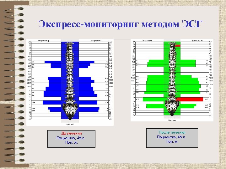 Экспресс-мониторинг методом ЭСГ До лечения Пациентка, 45 л. Пол: ж. После лечения Пациентка, 45