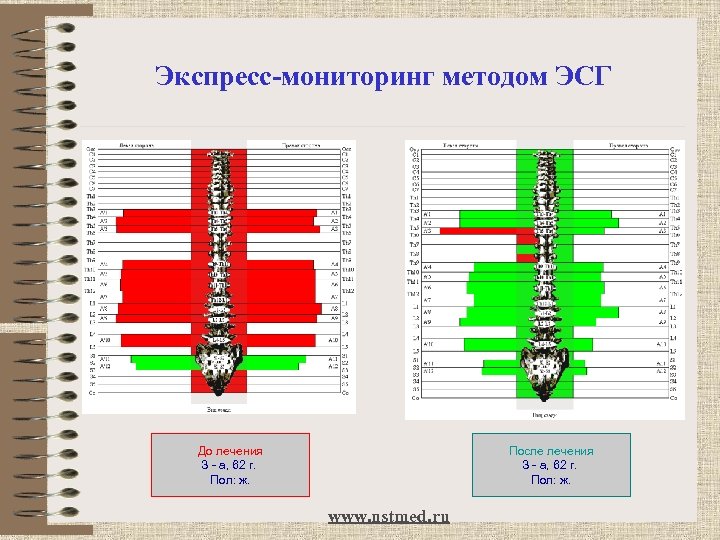 Экспресс-мониторинг методом ЭСГ До лечения З - а, 62 г. Пол: ж. После лечения