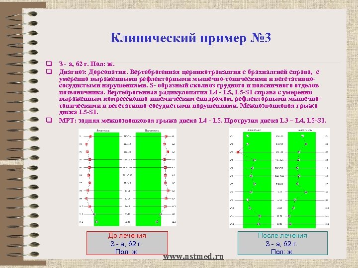Клинический пример № 3 q З - а, 62 г. Пол: ж. q Диагноз: