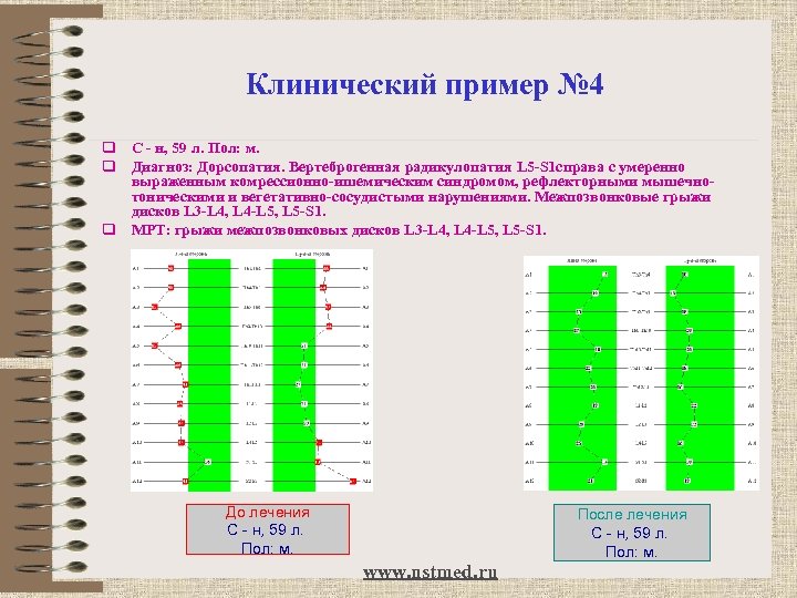 Клинический пример № 4 q C - н, 59 л. Пол: м. q Диагноз:
