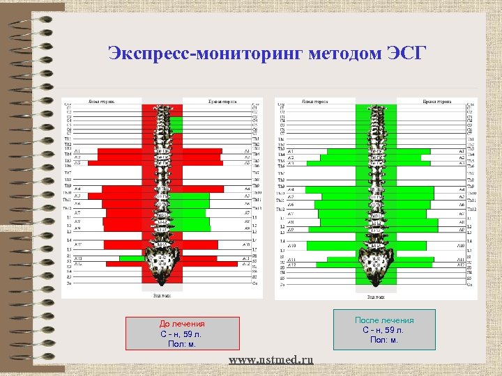 Экспресс-мониторинг методом ЭСГ После лечения С - н, 59 л. Пол: м. До лечения