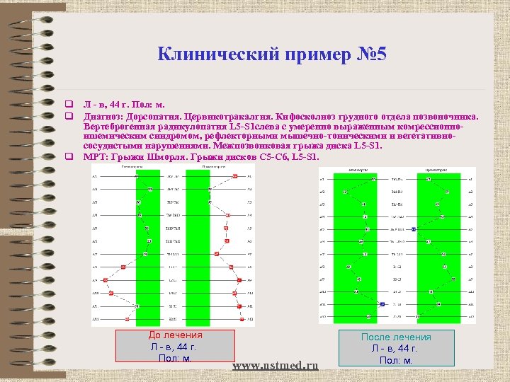 Клинический пример № 5 q Л - в, 44 г. Пол: м. q Диагноз: