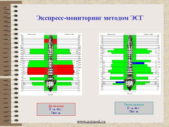 Экспресс-мониторинг методом ЭСГ После лечения Л - в, 44 г. Пол: м. До лечения