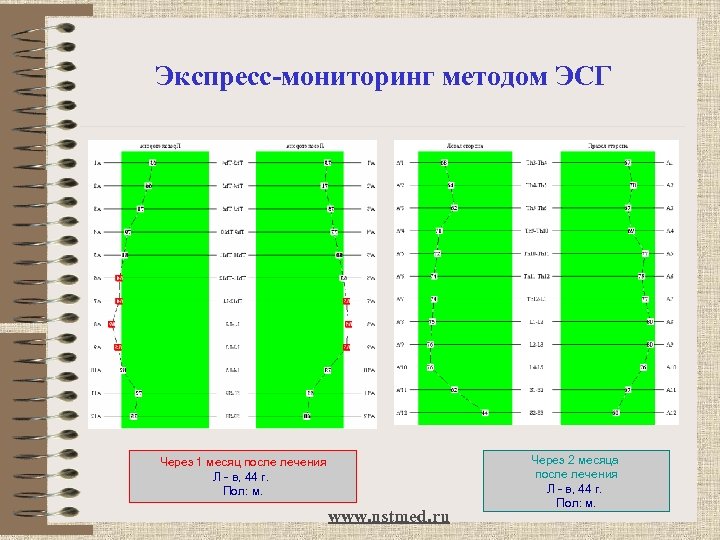 Экспресс-мониторинг методом ЭСГ Через 1 месяц после лечения Л - в, 44 г. Пол: