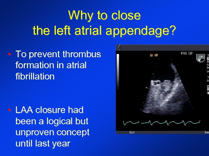 Why to close the left atrial appendage? • To prevent thrombus formation in atrial