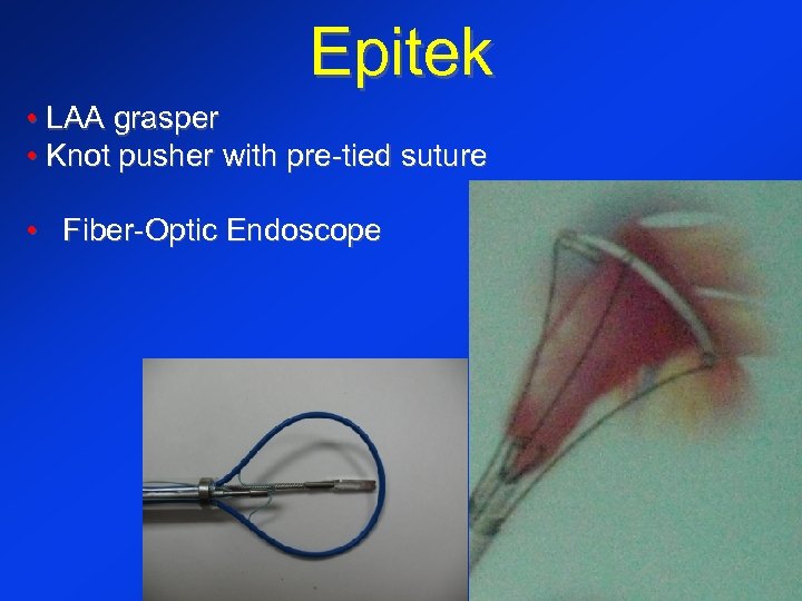 Epitek • LAA grasper • Knot pusher with pre-tied suture • Fiber-Optic Endoscope 