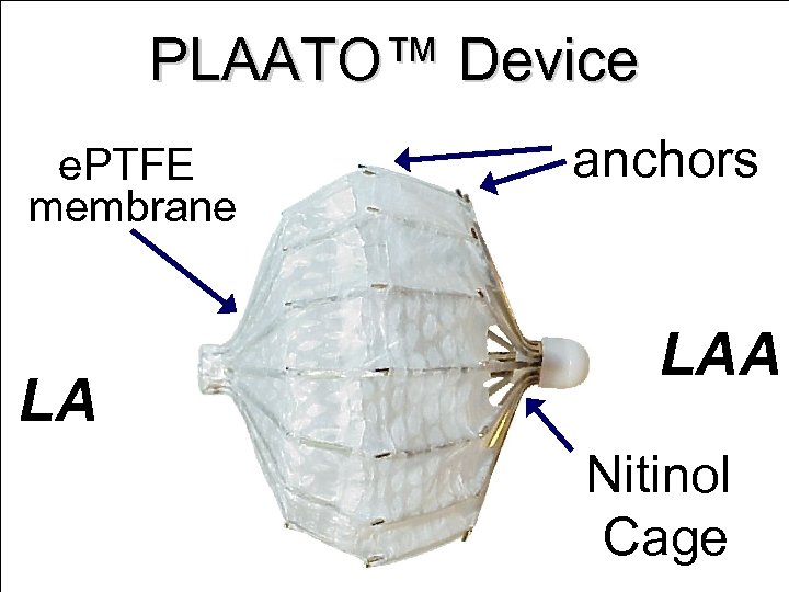 PLAATO™ Device e. PTFE membrane LA anchors LAA Nitinol Cage 
