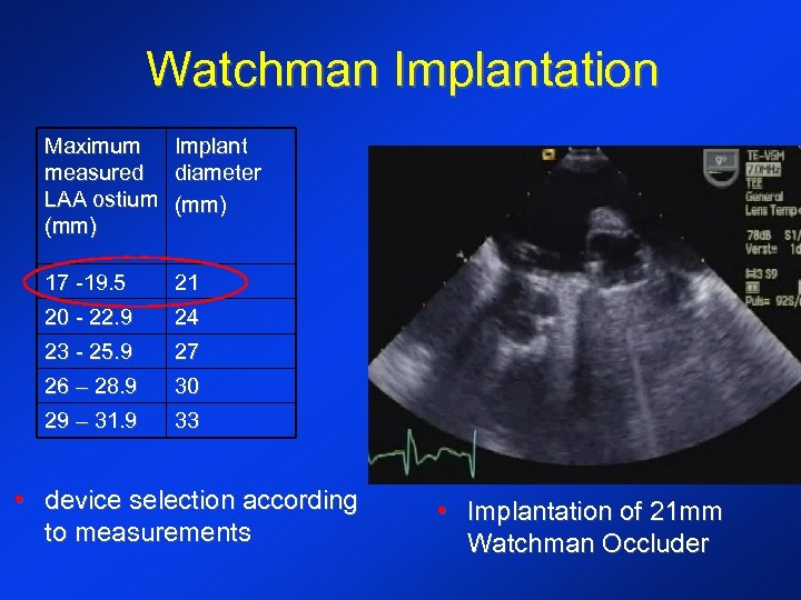 Watchman Implantation Maximum Implant measured diameter LAA ostium (mm) 17 -19. 5 21 20