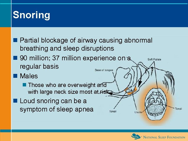 Snoring n Partial blockage of airway causing abnormal breathing and sleep disruptions n 90