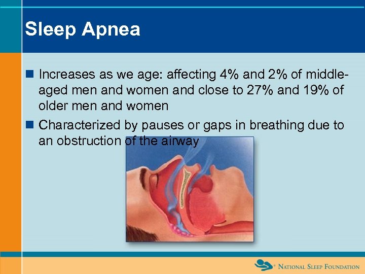 Sleep Apnea n Increases as we age: affecting 4% and 2% of middleaged men