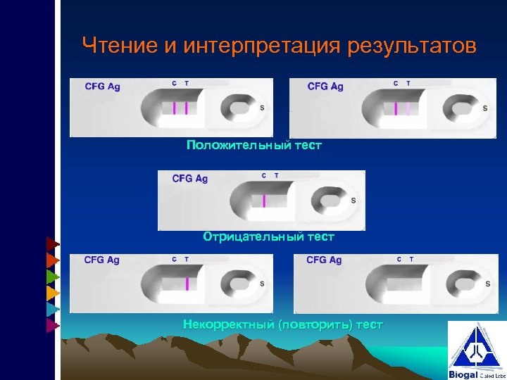 Результат экспресс теста. Интерпретация результатов экспресс теста. Экспресс тесты инфекционных заболеваний. Экспресс тест системы на грипп интерпретация. Корректный тест.