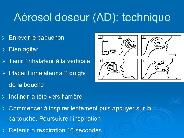 Aérosol doseur (AD): technique Ø Enlever le capuchon Ø Bien agiter Ø Tenir l’inhalateur