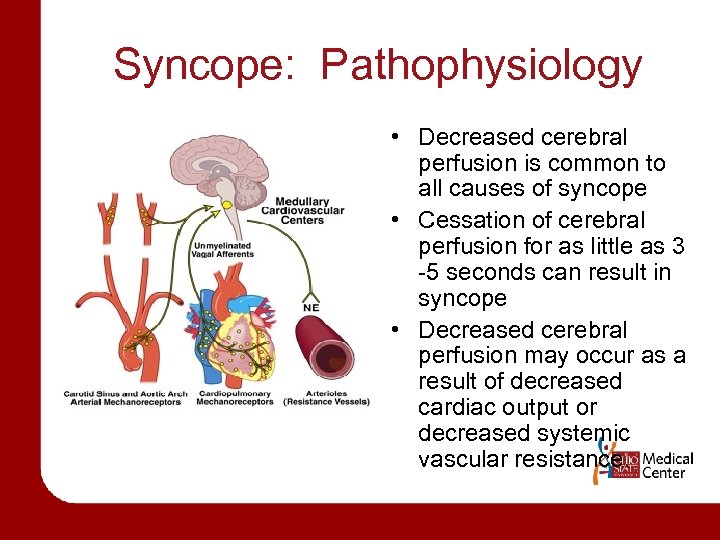 Syncope: Pathophysiology • Decreased cerebral perfusion is common to all causes of syncope •