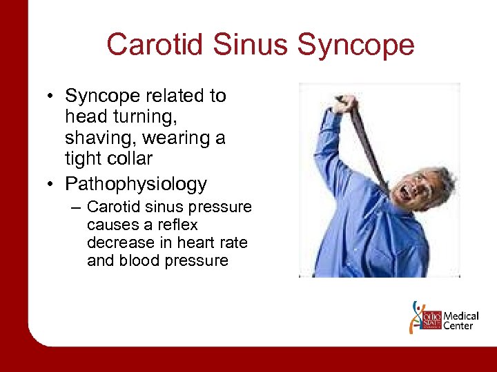 Carotid Sinus Syncope • Syncope related to head turning, shaving, wearing a tight collar
