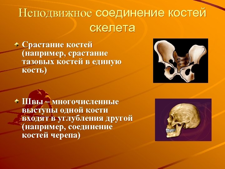 Кости скелета человека соединены неподвижно. Неподвижное соединение костей. Неподвижное соединение костей скелета. Кости с неподвижным соединением. Неподвижное соединение костей таза.