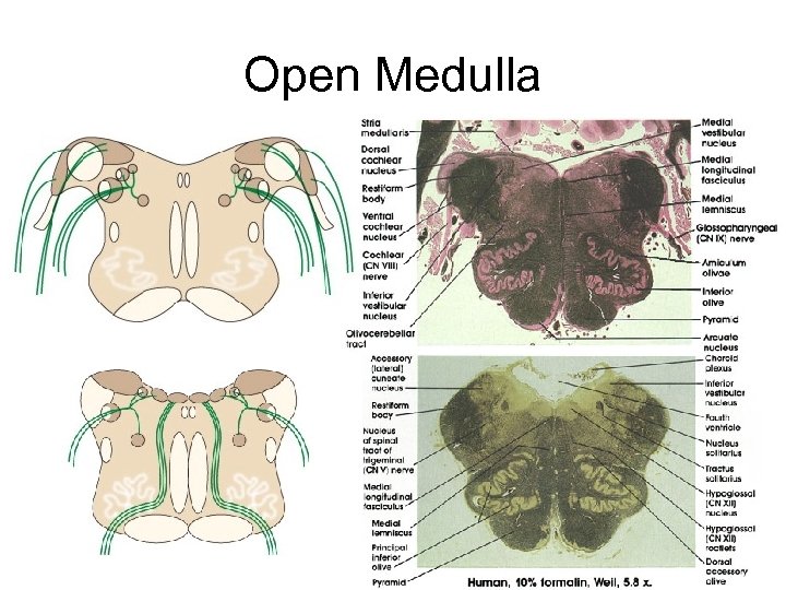 Open Medulla 