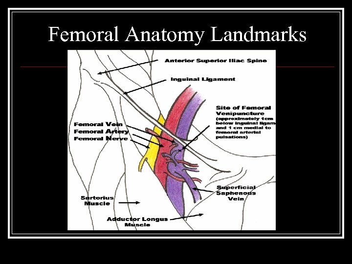 Femoral Anatomy Landmarks 