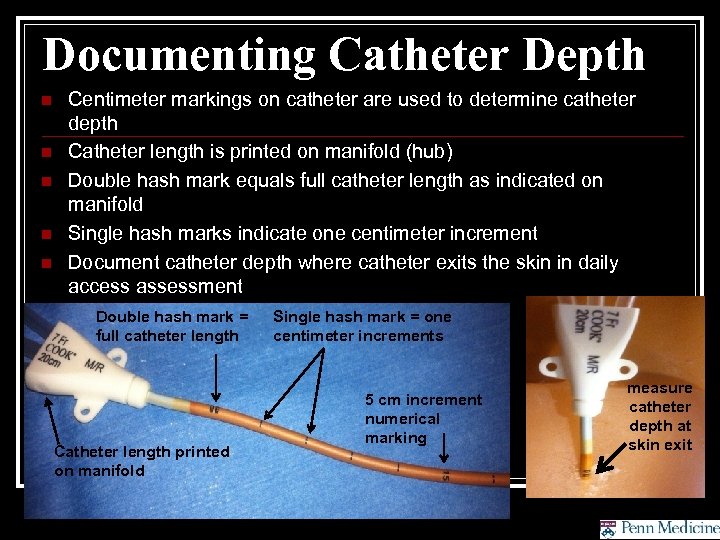 Documenting Catheter Depth n n n Centimeter markings on catheter are used to determine