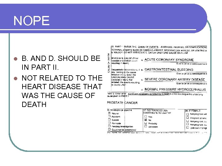 NOPE B. AND D. SHOULD BE IN PART II. l NOT RELATED TO THE