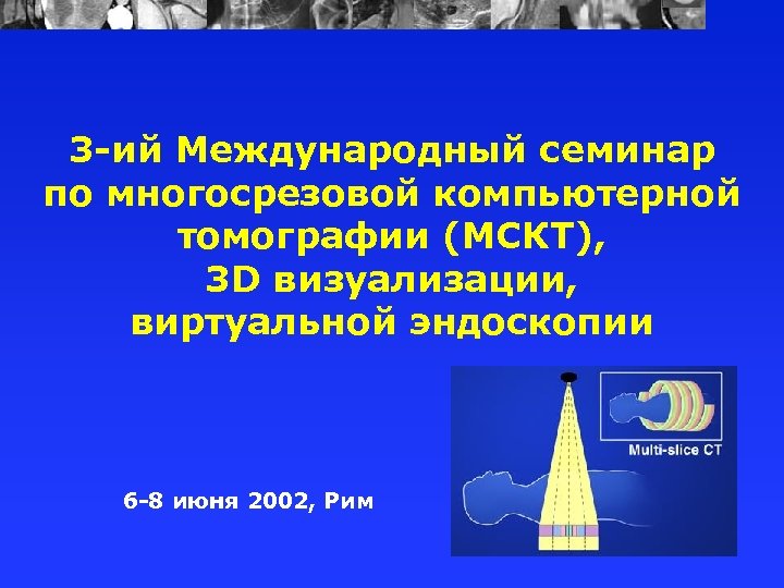 3 -ий Международный семинар по многосрезовой компьютерной томографии (МСКТ), 3 D визуализации, виртуальной эндоскопии