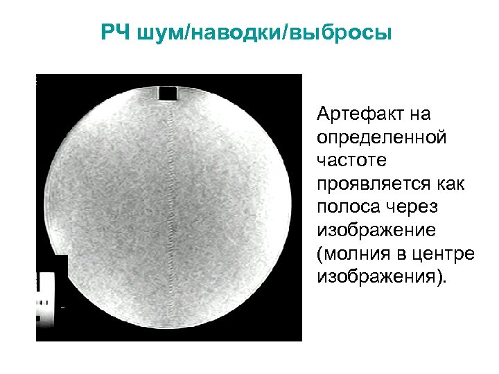 РЧ шум/наводки/выбросы Артефакт на определенной частоте проявляется как полоса через изображение (молния в центре