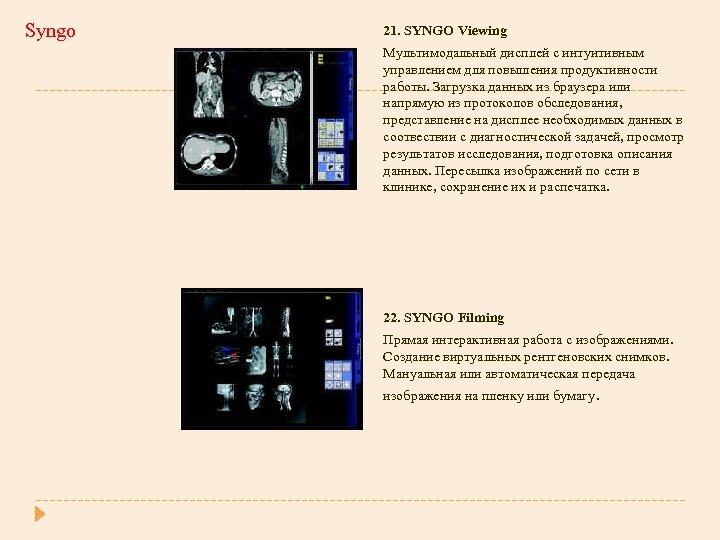 Syngo 21. SYNGO Viewing Мультимодальный дисплей с интуитивным управлением для повышения продуктивности работы. Загрузка