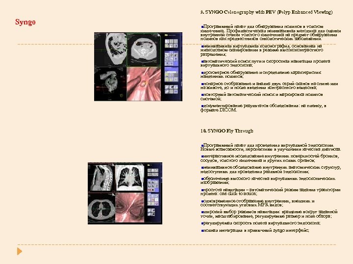 9. SYNGO Colonography with PEV (Polyp Enhanced Viewing) Syngo Программный пакет для обнаружения полипов