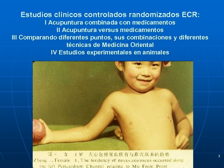 Estudios clínicos controlados randomizados ECR: I Acupuntura combinada con medicamentos II Acupuntura versus medicamentos