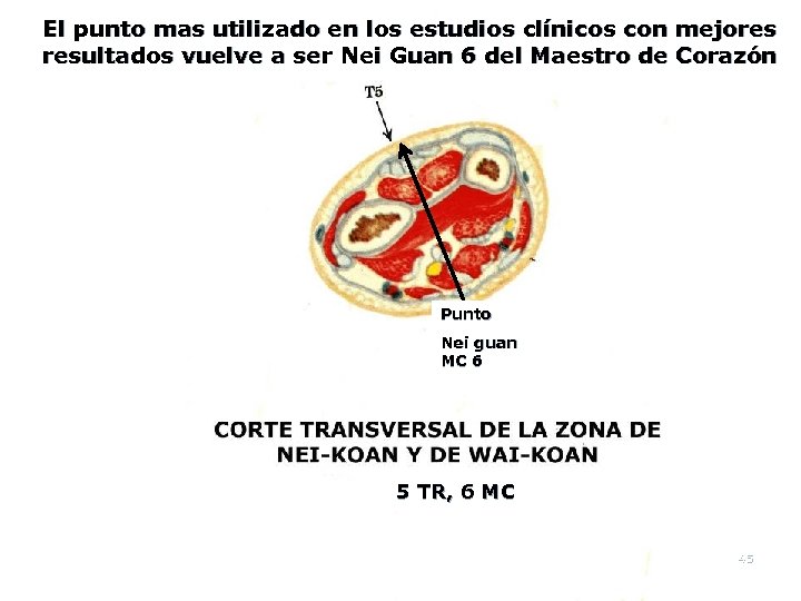 El punto mas utilizado en los estudios clínicos con mejores resultados vuelve a ser